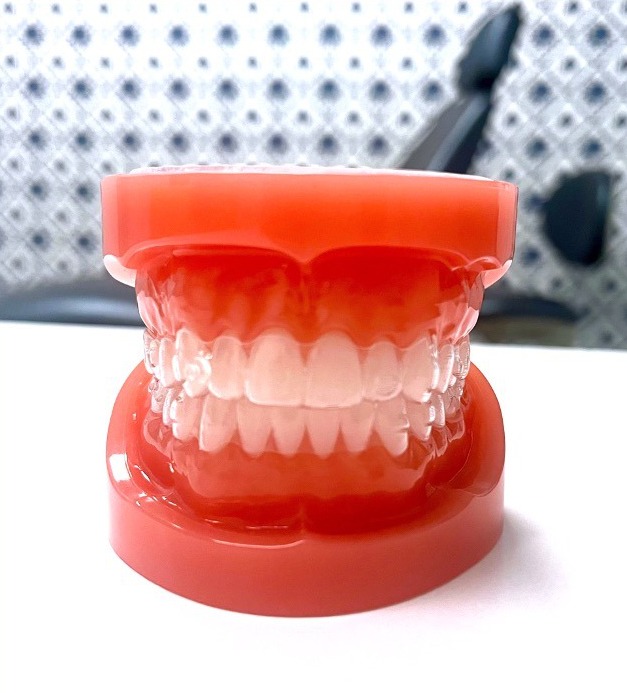 invisalign aligners on plastic model